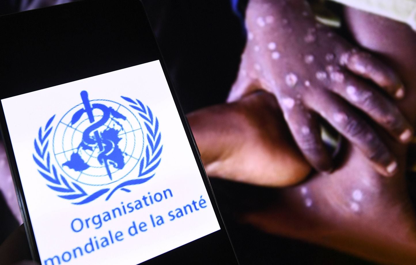 Pero ¿por qué los teóricos de la conspiración están tan centrados en la Organización Mundial de la Salud? Pero ¿por qué los teóricos de la conspiración están tan centrados en la Organización Mundial de la Salud?